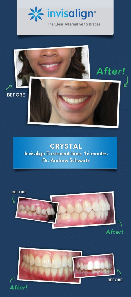 invisalign results fix dental issues_crystal